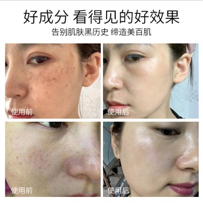 院线专供打造素颜灯泡肌调肤套祛铅汞斑大花脸去黄美白护肤品套装